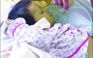 患病女童全身變綠