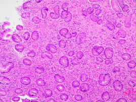 組織細胞 組織細胞