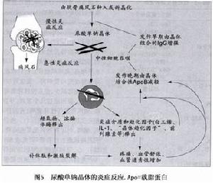 痛風和高尿酸血症