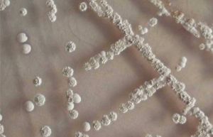 烴類發酵 烴類發酵