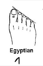 埃及腳