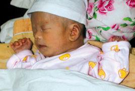 雙性嬰兒 雙性嬰兒