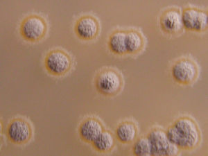 假委內瑞拉鏈黴菌 假委內瑞拉鏈黴菌