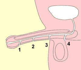 尿道口下裂 尿道口下裂