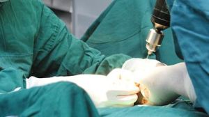 冷凍外科手術 冷凍外科手術