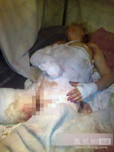 3·9烏克蘭官二代輪姦焚燒少女案