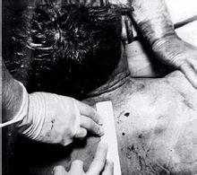 甘迺迪屍檢照片