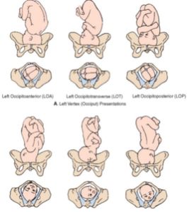 胎點陣圖 胎點陣圖