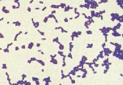 革蘭氏陽性細菌