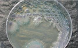 偽熱帶念珠菌 偽熱帶念珠菌