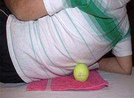 筋膜疼痛 筋膜疼痛