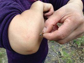 蜂療[中國傳統自然療法]