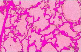 基質金屬蛋白酶