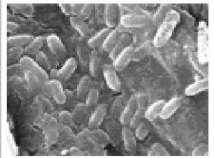 解澱粉芽孢桿菌