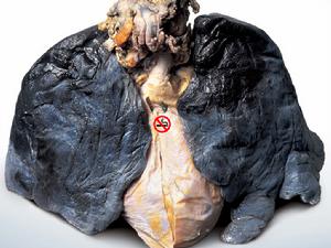 （圖）吸菸與不吸菸的肺區別