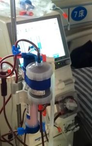 血液灌流 血液灌流