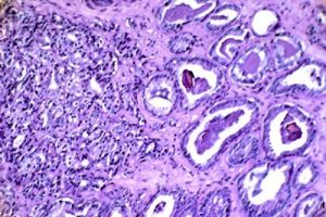 （圖）基因變異因素