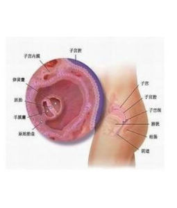 子宮內膜炎 子宮內膜炎