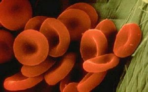 ABO血型決定子 ABO血型決定子