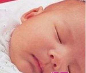 嬰兒肝炎綜合徵