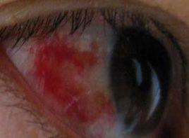 看東西有小黑點 看東西有小黑點