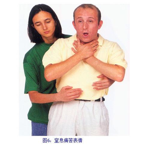 急性呼吸道堵塞