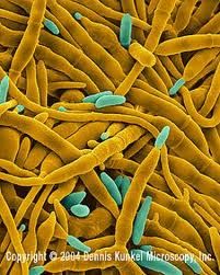 串珠鐮孢 串珠鐮孢