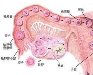 多囊卵巢綜合症