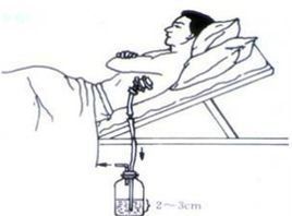 胸腔閉式引流 胸腔閉式引流