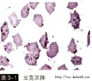 豬紅體病 豬紅體病