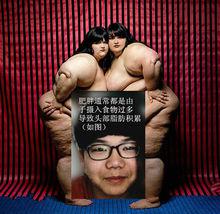 臉部肥胖的緣由