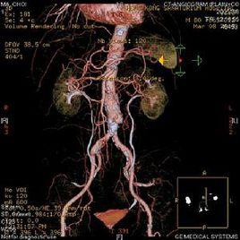 慢性病性貧血 慢性病性貧血