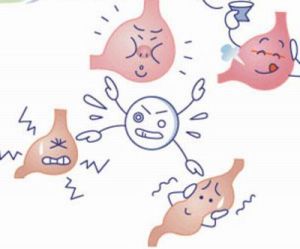 淺表性胃炎 淺表性胃炎