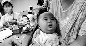 新生兒單純皰疹病毒感染