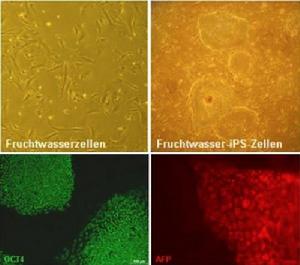從圖片上部的兩幅圖的對比中可以看到，羊水細胞從外表看來與其它胚胎幹細胞有很大區別；左下角的圖片表示羊水細胞的iPS細胞可產出蛋白質的製造者之一“OCT4”；右下角的圖片表示iPS細胞能夠夠形成人體各種器官和組織的幹細胞。