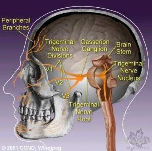 腦角質瘤
