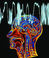 繼發性癲癇病 繼發性癲癇病