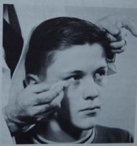 角膜反射檢查法