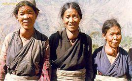 大脖子病人 大脖子病人