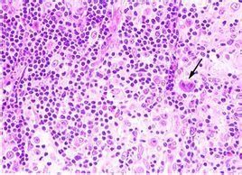 鏡影細胞 鏡影細胞