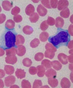 傳染性黃疸 傳染性黃疸