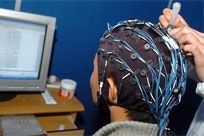 無抽搐電休克 無抽搐電休克