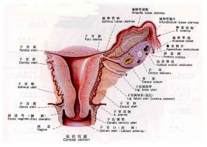 子宮內膜異位性不孕症