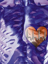 竇性心動過緩 竇性心動過緩