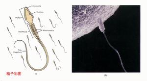 男性生殖系統結核