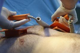 心臟電復律 心臟電復律