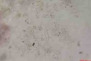 史氏布紋藻 史氏布紋藻