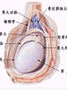 睪丸囊腫