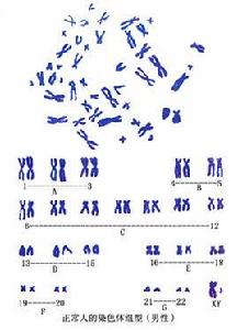 染色體組型 染色體組型