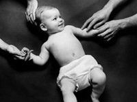 寶寶肋骨外翻 寶寶肋骨外翻